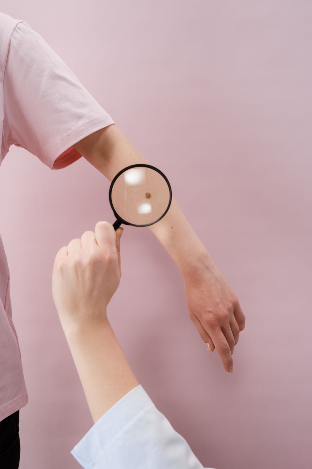 Examining a mole with a magnifier